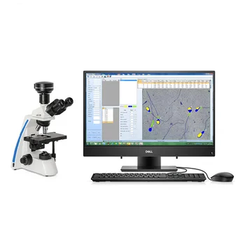 Анализатор на подвижността на сперматозоидите M126 оборудване за ин ВИТРО анализатор на спермата